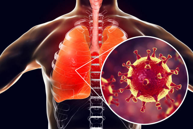 Strategies for fighting respiratory syncytial virus