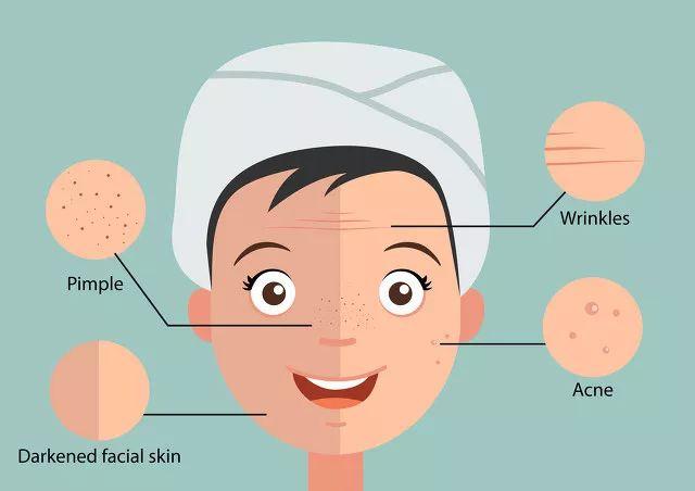 Why do you still have acne after puberty?